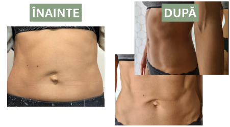 Transformare Cristina – înainte și după